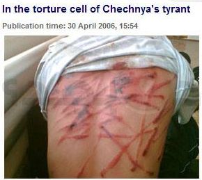 حقيقة صورة ملتقطة للتعذيب داخل سجون مصر.
