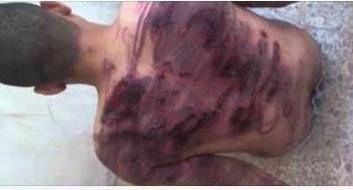 حقيقة صورة تعذيب داخل أحد السجون المصرية