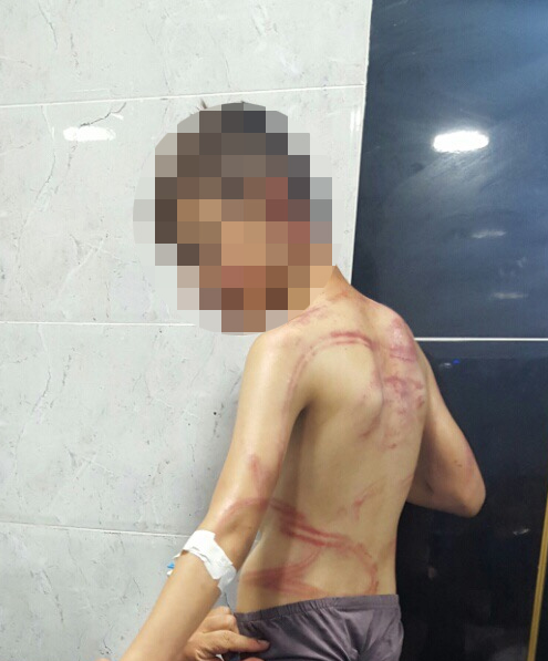 حقيقة صورة تعذيب طفل في السجون المصرية